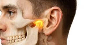 Read more about the article TMJ Pain or Just a Headache? How to Tell the Difference (And When to See a Dentist)