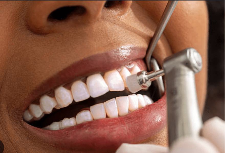 You are currently viewing How Often Should You Really Get Your Teeth Cleaned? A Dentist Explains
