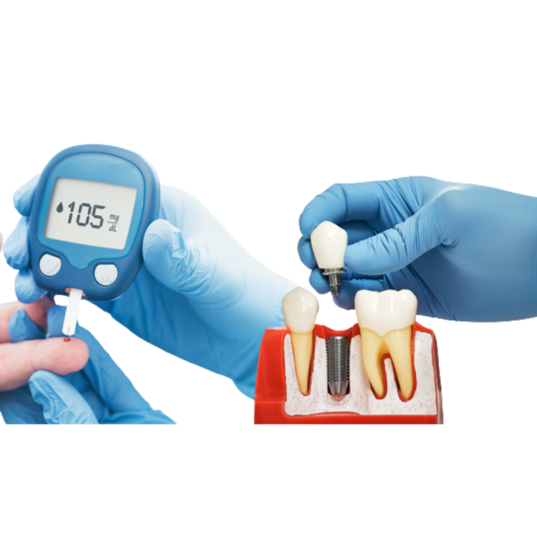 Read more about the article Can Diabetic Patients Get Dental Implants?
